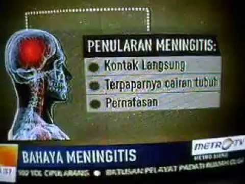 Terungkap inilah penyakit yang diderita Olga Syahputra