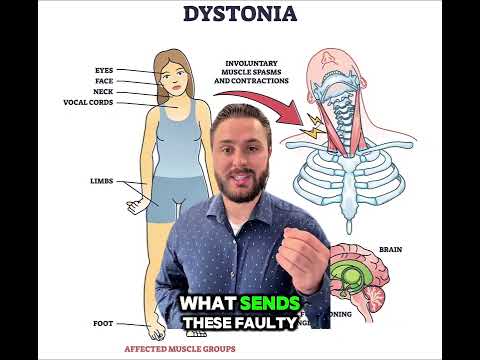 ⚡ Living with spasmodic torticollis or cervical dystonia?