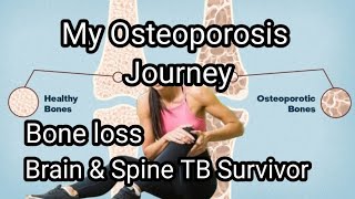 My Osteoporosis Journey | Bone loss | TB Survivor| Colours of life.