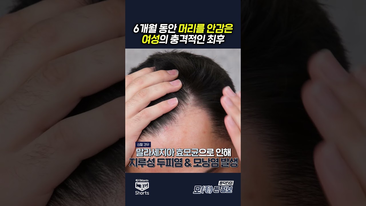 더원츠의원 숏폼
