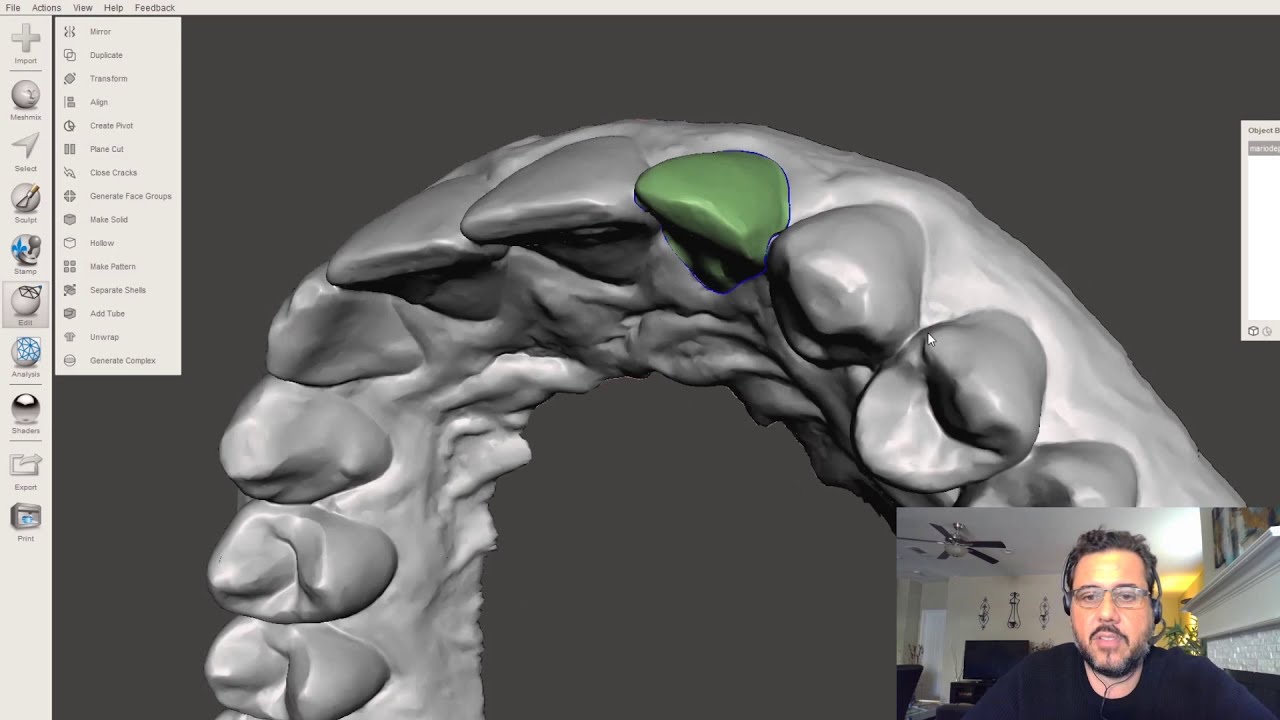 Planejamento Ortodôntico Digital Gratuito - Meshmixer
