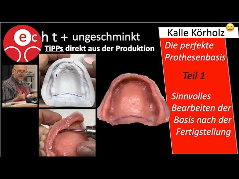 Nacharbeiten der auspolymerisierten Prothesenbasis Teil 1