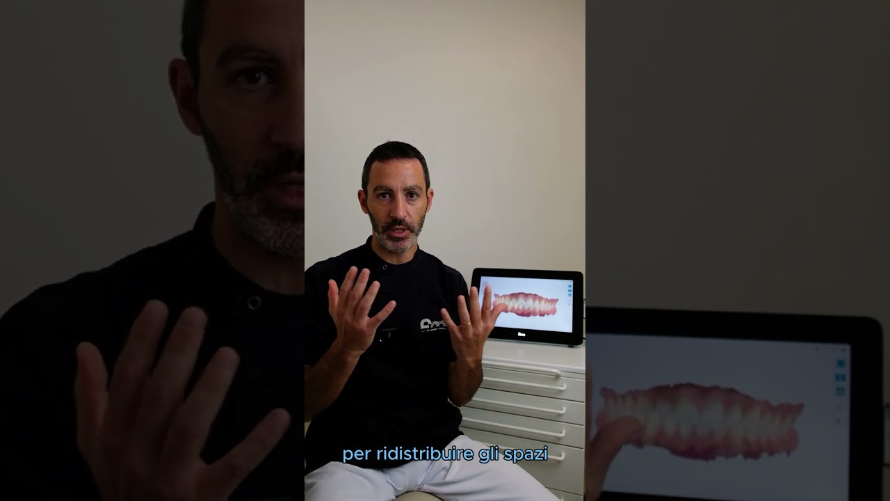 Ortodonzia con Invisalign