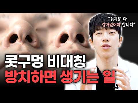 코수술 후 콧구멍 비대칭 방치하면 생기는일 ?ㅣ디에이성형외과