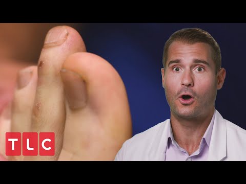 His Toes Look Like "ET Fingers" | My Feet Are Killing Me