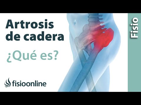 Il dolore delle vertebre della colonna vertebrale cervicale Danni al trattamento menisco del ginocchio a casa