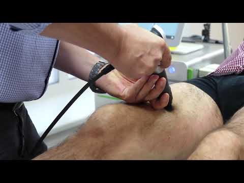 Storz Medical Product video Applicateurs Peri Actor I Fascias Masterpuls Ultra line