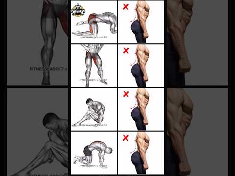 How To Fix Anterior Pelvic Tilt