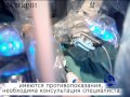 Операции с применением робота-хирурга в КДЦ "Здоровье"