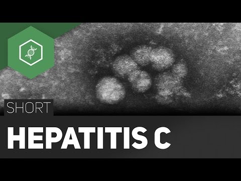 Dass die zweite Stufe ist Hypertension Hypertonie bei jungen Männern