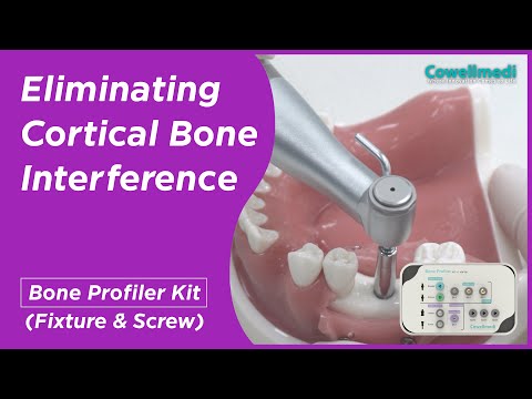 Distribution Network Thumbnail