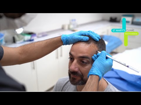 Logo of From Thin to Thick: Ian Janvil’s Hair Transplant Experience