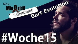 Das Minoxidil Experiment #Woche15 Meine Bartentwicklung und Bartdetails