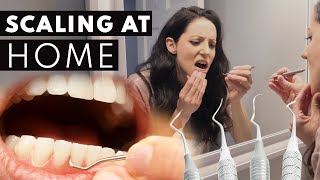 Scaling Your OWN Teeth At Home? Here Is Why It