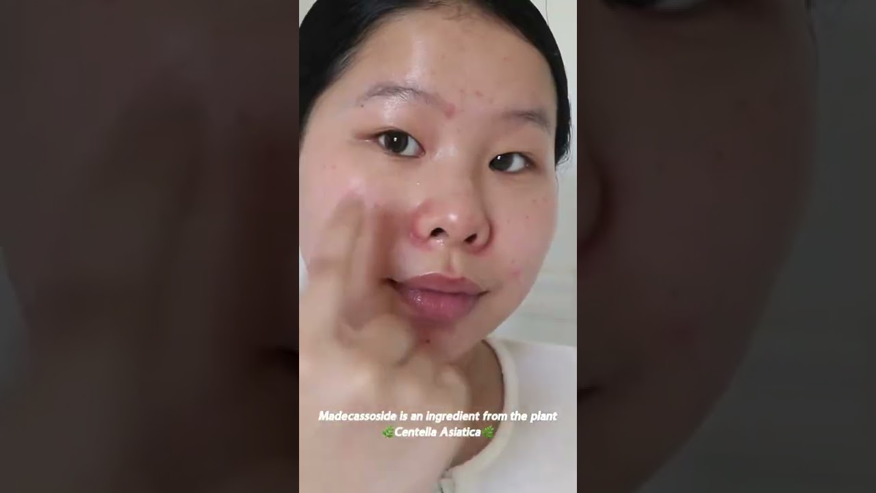 Trying out La Roche Posay’s Cicaplast Balm B5- is it worth the hype 🤔