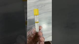 Download lagu Clot Activator tube! yellow tops tube! Gel tube blood collection vacutainer ! Serum Separating tube mp3 Download lagu Clot Activator tube! yellow tops tube! Gel tube blood collection vacutainer ! Serum Separating tube mp3