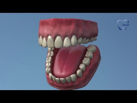 Férula de descarga importancia