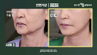 �ȸ�Ż� ���� ���� 4���� ��� | ���� ��ȭ �Ѵ��� ����