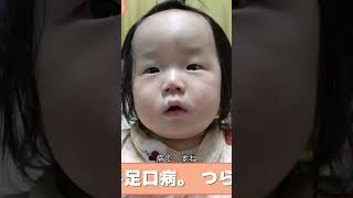 東京都で2年ぶりの手足口病警報！初期症状からブツブツまで詳しく解説 #shorts #切り抜き #手足口病