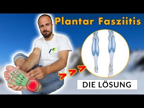 How to get rid of plantar fasciitis (no more heel pain)
