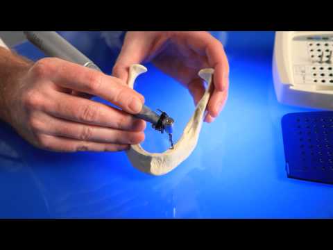 Depth Control with Zimmer Dental Drill Stop Kit | Enamel Pearls