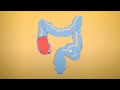 Why You Shouldn T Worry About Pooping Once A Day Body Stuff With Dr Jen Gunter TED