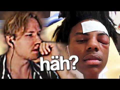 Kirdez Reagoi IShowSpeed SILMÄVAURIOON?!