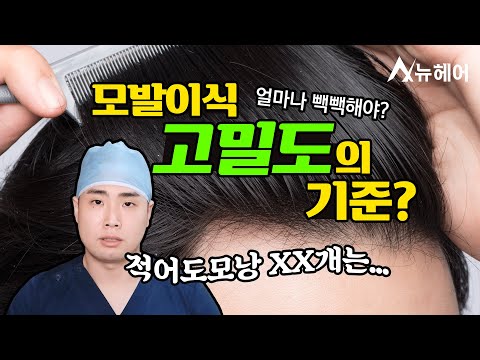 모발이식 의사가 말하는 고밀도 모발이식의 기준ㅣ뉴헤어