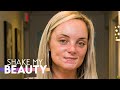 My Ex Disfigured My Face - Now I'm Helping Other Victims | SHAKE MY BEAUTY