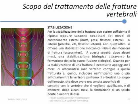 Anemia e articolazioni Dolore nel tessuto molle sopra la vita