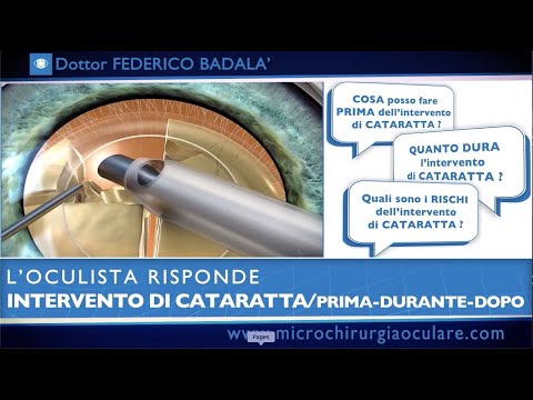 Intervento di Cataratta: Cosa Succede Prima, Durante e Dopo. L’Oculista Risponde