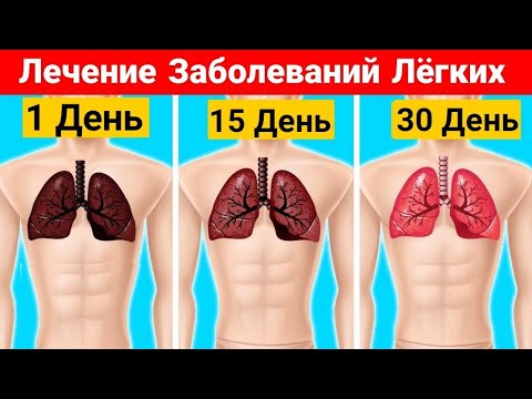 4 Домашних Средства Для Лечения Заболеваний Лёгких