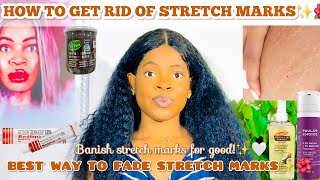 *HOW TO GET RID OF STRETCH MARKS* |Causes, Treatment, Prevention and Best Way To Fade Stretch Marks