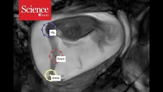 Snippet: Tracking fetal movements at 24 weeks