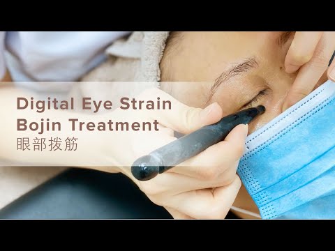 Digital Eye Strain Bojin Treatment (眼部拨筋)
