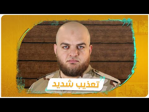 تقرير يعرض صورة لـ "إسلام علوش" تظهر تعرضه لضرب مبرح في مكان احتجازه بفرنسا ويسرد تفاصيل الاحتجاز