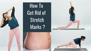 Exercise for Stretch Marks at home | Toning Workout | Somya Luhadia