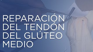 Reparación del tendón del glúteo medio