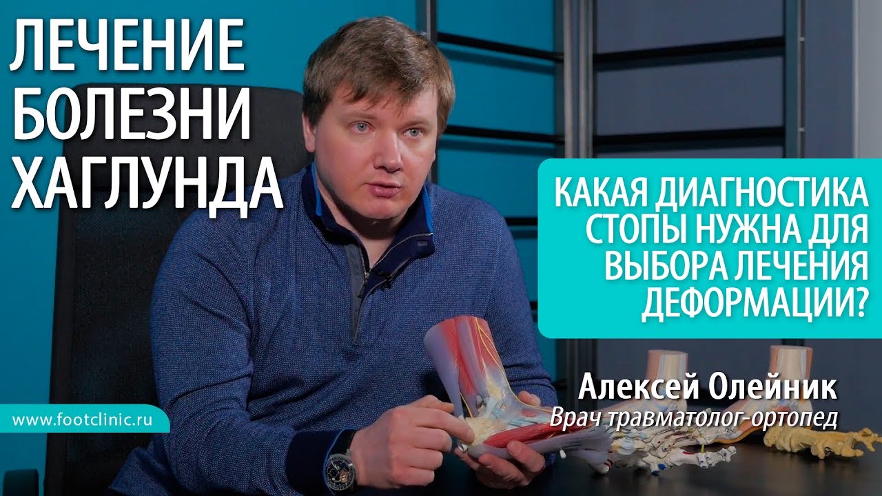 Видео по теме Деформация Хаглунда