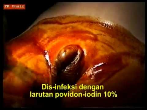 Produk yang meningkatkan potensi Ampul untuk potensi