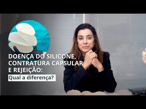 Entenda a diferença entre: Contratura capsular, rejeição e doença do silicone