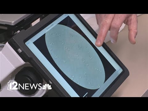 Valley Fever cases surging across Arizona