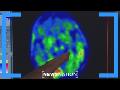 Lithium may reverse Alzheimer’s disease: Study | Elizabeth Vargas Reports