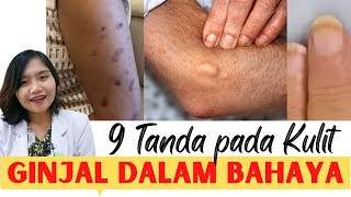 9 GEJALA AWAL KULIT SAAT SAKIT GINJAL | dr. Emasuperr