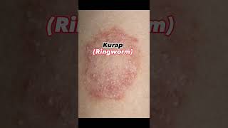 Download lagu Sekarang nampaknya daun ni dah komersil orang buat krim dan sabun.. #kurap #ringworm  #gelenggang mp3
