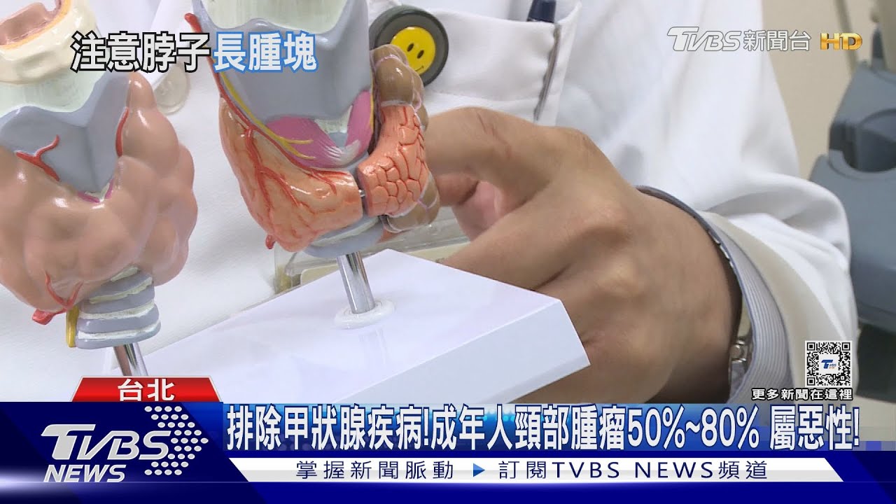 成年人腫塊長在「這部位」 排除甲狀腺疾病惡性機率五成以上