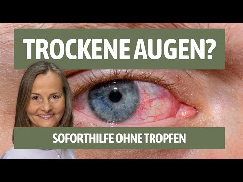 Trockene Augen? So wirst du sie ohne Tropfen los