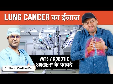 Lung Cancer Treatment | Benefits Of Robotic Surgery | Video-Assisted Thoracic Surgery (VATS) Delhi