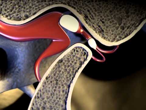 3D Medical Animation - Temporomandibular Joint || ABP ©