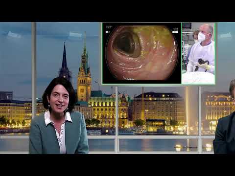 DGE-BV online symposium – Intelligente Systeme in der Endoskopie, Live Koloskopie mit KI, Kießlich